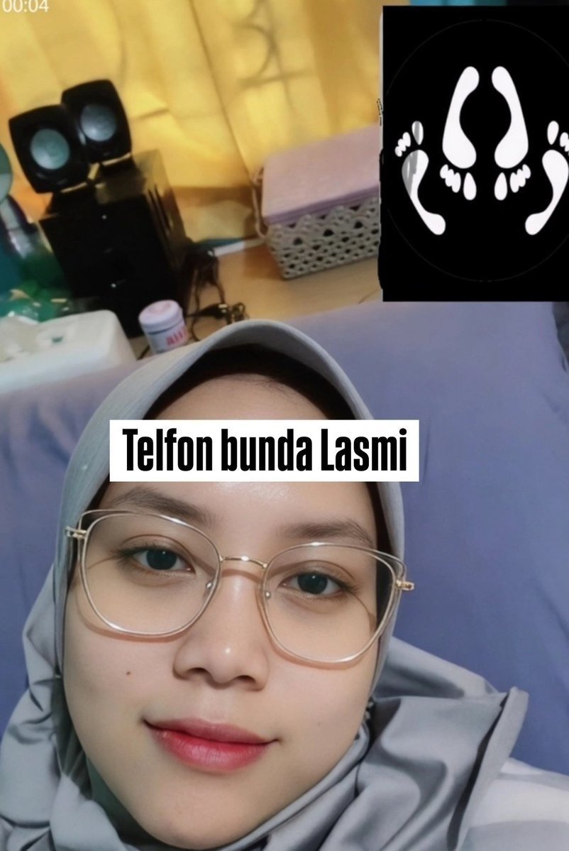 fixdne's tweet photo. Live dulu gak sih

https://t.co/Gl6OguDLGC
https://t.co/hH4KwAtWJm https://t.co/FXTvi9QJ3c
