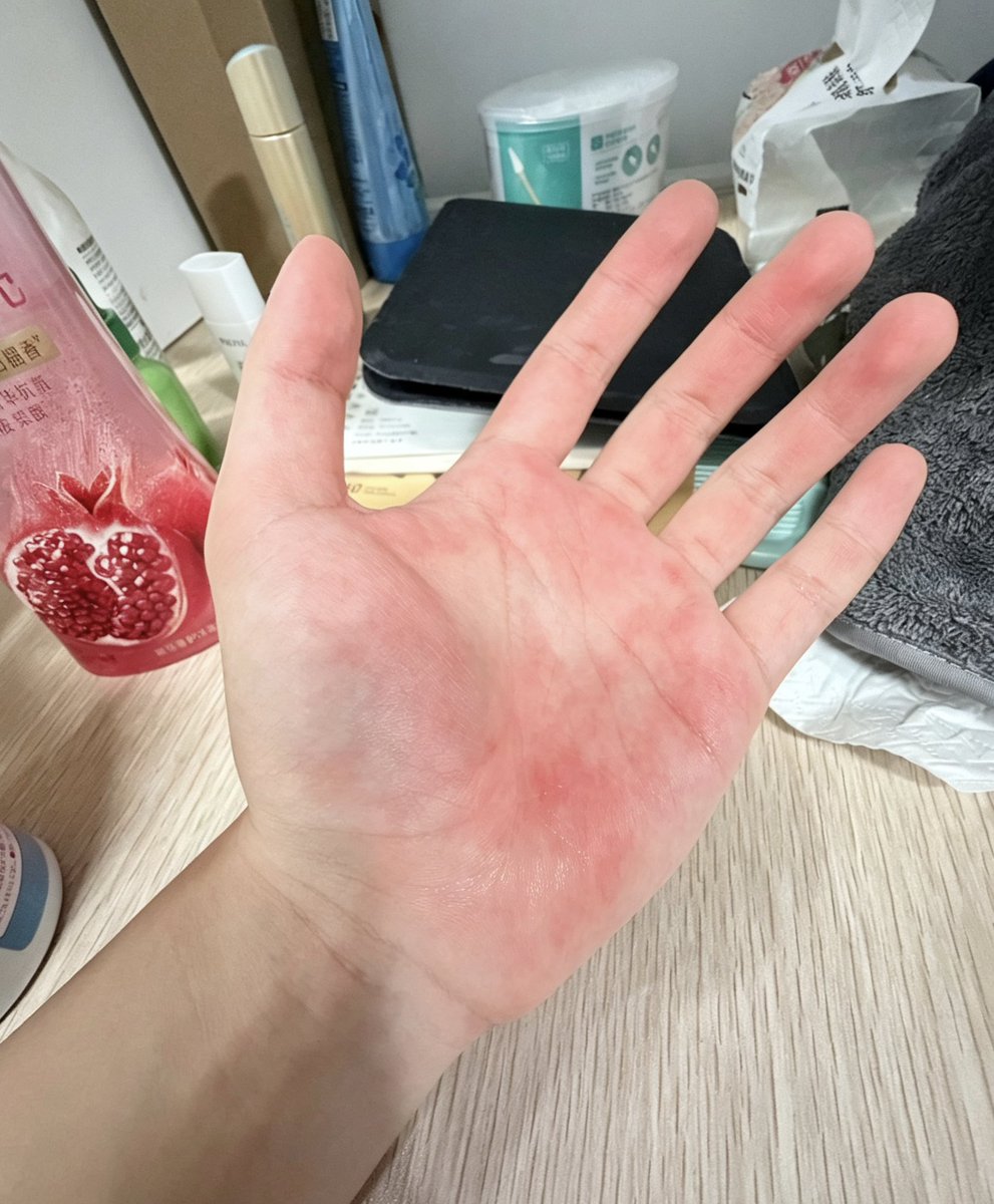 Ndzzlfs08's tweet photo. 有讨厌手洗内裤袜子的吗😅不敢用学校的洗衣机洗私密衣物，攒了好几天又不得不洗，每次洗完手都痛痛的😭 https://t.co/zJvWnO2Kqe