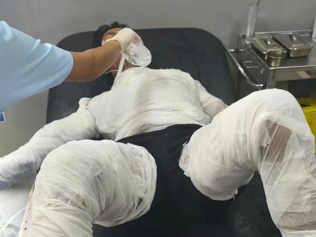 ruangantara0's tweet photo. KABAR DUKA :
Setelah dirawat di RS Sanglah, seorang sopir yang dibakar bos nya akhirnya menghembuskan nafas terakhir. 

I Gede Selamet (21), sopir truk yang dibakar bosnya, I Putu Cahyadi Putra (37), di Muncan, Selat, Karangasem, meninggal dunia di RSUP Prof Ngoerah, Denpasar, Jumat (25/9/2026).

Kapolsek Selat AKP Ida Bagus Astawa mengatakan pasal yang dikenakan tetap Pasal 467 KUHP, namun ayatnya berubah dari ayat (2) menjadi ayat (3) karena korban meninggal dunia.

Dengan perubahan tersebut, ancaman hukuman tersangka menjadi maksimal 9 tahun penjara, dari sebelumnya 7 tahun.

#Karangasem #Bali #BeritaBali #Kriminal #Muncan #Selat #GedeSelamet