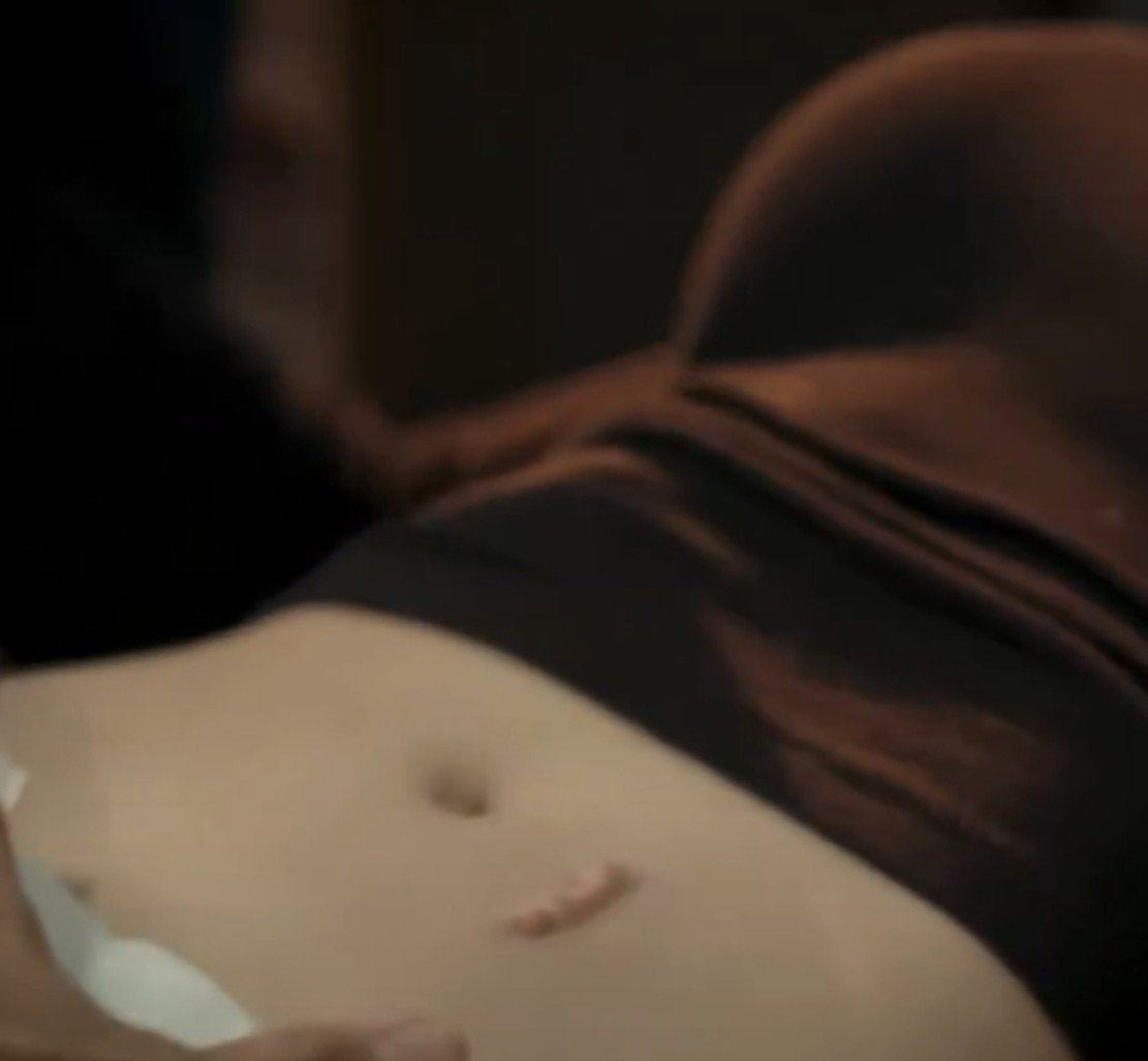 pookiestemin's tweet photo. her kidney scar and we didn't see him surprised and teary eyed bcz bcz his ass already seen it multiple times and we didn't get to see his first time reaction to it IM SO MAD 😭 #arafta https://t.co/tzVsbu5NF8