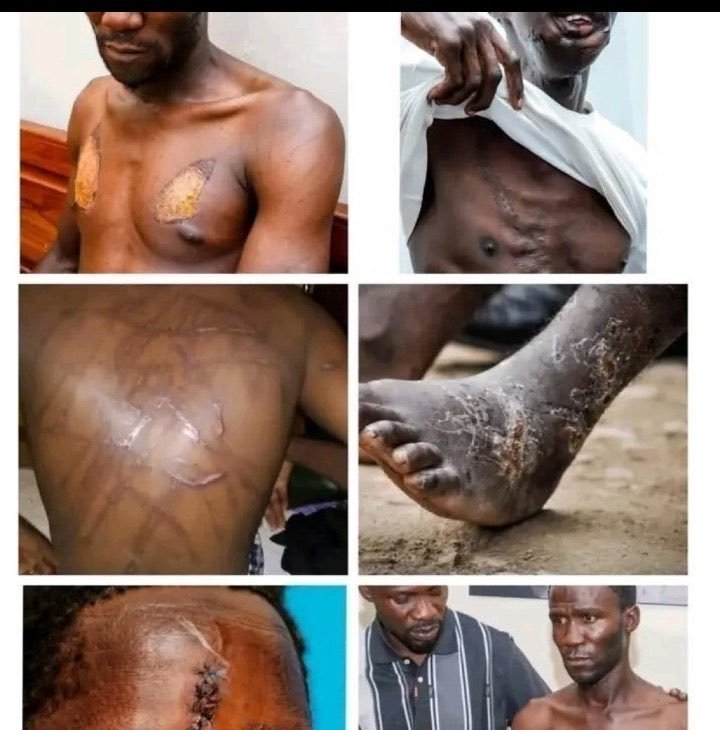 Sempira4freedom's tweet photo. THE LUWERO LIE!
- 1981-85, Museveni starts bush war in Luwero.
- 600,000+ civilians dead.
- Used them as human shields, blamed Obote, then paraded their skulls for power.
- UPC demanded a forensic inquiry. Museveni refused. Why? https://t.co/HA13zar3J2