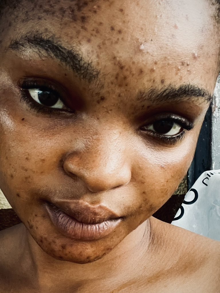 guzu_p's tweet photo. See who this nincompoop is calling a 10?

Now, you all understand why every woman thinks she's beautiful.

Nigerian men too useless. https://t.co/A0aglNMTD1