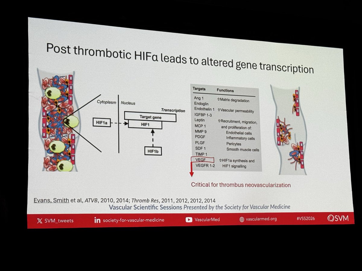 DanielleV_PA's tweet photo. Amazing work by Dr. Obi and her venous colleagues!  Excellent keynote presentation! 
#SVM2026 @SVM_tweets https://t.co/MfoKmYeVC4
