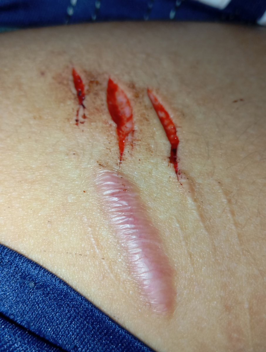 dtk8_'s tweet photo. Amo quando a maquiagem que eu faço sai do jeito que eu imaginei (sangue falso) #sfx #sfxmakeup #fake https://t.co/sp1gPcMuG0