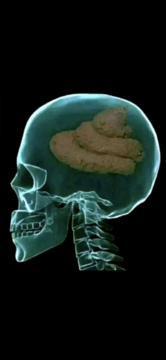 moSparky2's tweet photo. @SayWhat696 @Germanx1984 @KULIRAM1976 Your 🧠 is full of shit https://t.co/VBRJysBUea