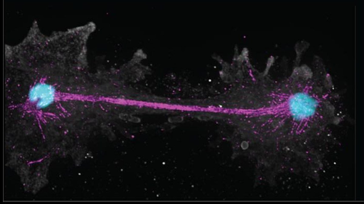 realsomehow's tweet photo. This cell is dividing at 63°C (145°F).

It also happens to make a pretty good picture.

Credit: Felix Mikus · CC BY-SA https://t.co/S3JHA8afzn