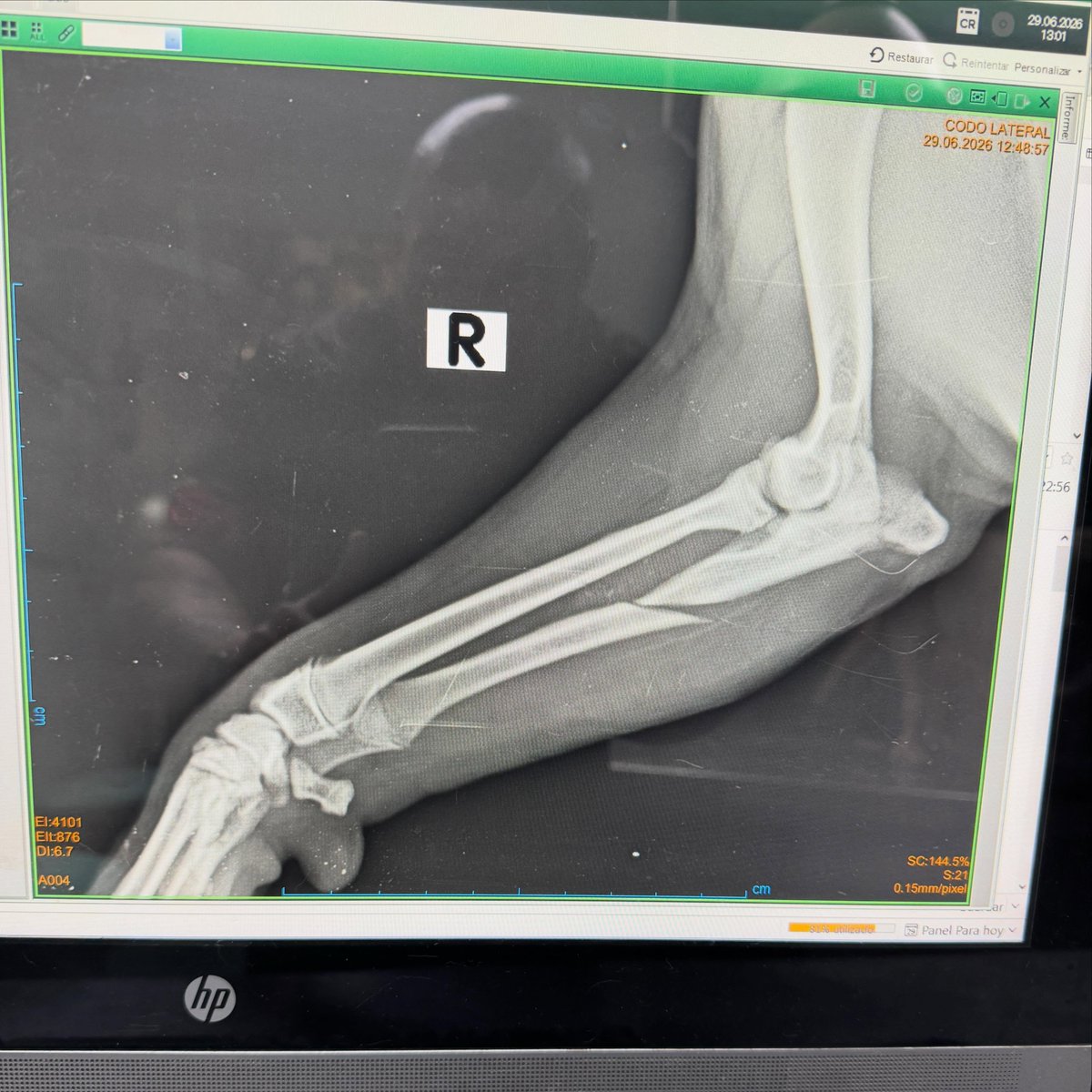 ChaseDubactd's tweet photo. Recuperándome de mi operación de la patita para volver a tener una vida más feliz y saludable. Gracias por preocuparos. ¡Os mando muchos lametones! https://t.co/G8PckyVVm0