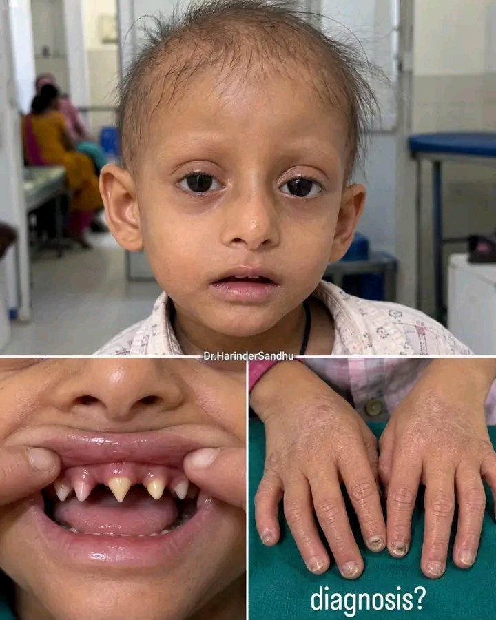 DoctorMed0's tweet photo. What Will be your diagnosis..?? https://t.co/qDbvaHW6he