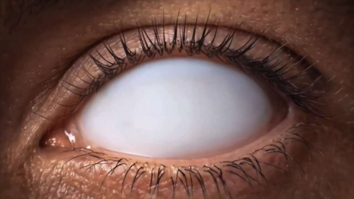 superTV247's tweet photo. Another eye from the advert has come to fruition 👀 #BBUK https://t.co/o62Pl1kse4