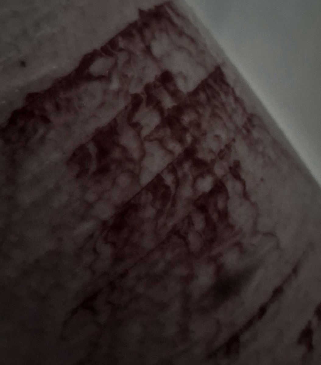 SoftPainVox's tweet photo. Re-up. 
The rain water soaked through my pant leg and definitely seeped into a scratch. Infection fears me. https://t.co/LdMgE7MAIv