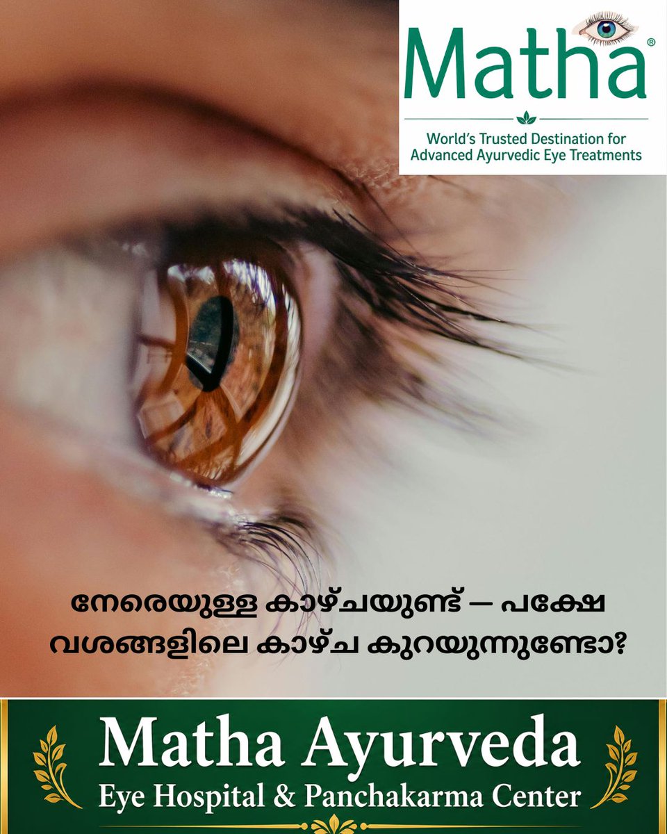 arunjithp's tweet photo. രോഗം പുരോഗമിക്കുമ്പോൾ, വശങ്ങളിലുള്ള കാഴ്ച (Peripheral/Side Vision) ക്രമേണ കുറയാം. അതേസമയം, നേരെ മുന്നിലുള്ള Central Vision പലപ്പോഴും കൂടുതൽ കാലം നിലനിൽക്കാം. അതുകൊണ്ടുതന്നെ തുടക്കത്തിൽ കാഴ്ചയിലെ മാറ്റങ്ങൾ രോഗിക്ക് വ്യക്തമായി മനസ്സിലാകണമെന്നില്ല.

Glaucoma കൂടുതൽ പുരോഗമിക്കുമ്പോൾ Visual Field ക്രമേണ ചുരുങ്ങുകയും, advanced stage-ൽ Central Vision-നെയും ബാധിക്കുകയും ചെയ്യാം. അതിനാൽ IOP മാത്രം നോക്കാതെ Optic Nerve-ന്റെയും Visual Field-ന്റെയും അവസ്ഥ കൃത്യമായി വിലയിരുത്തുന്നത് പ്രധാനമാണ്.

Click here to watch>>>https://t.co/QOZllyF9JS