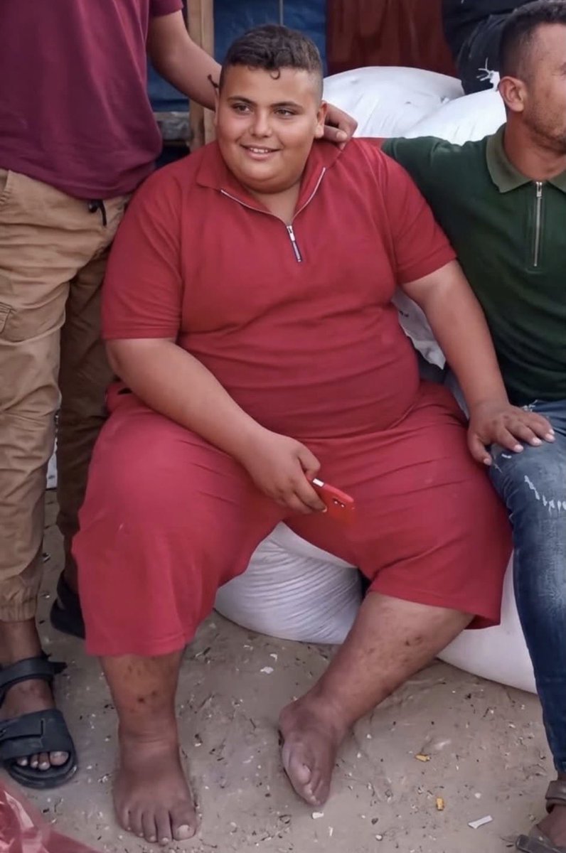 sabra_the's tweet photo. According to msm and Ms Rachel this is a famine victim… in Gaza . https://t.co/IrQ6gIj3BX