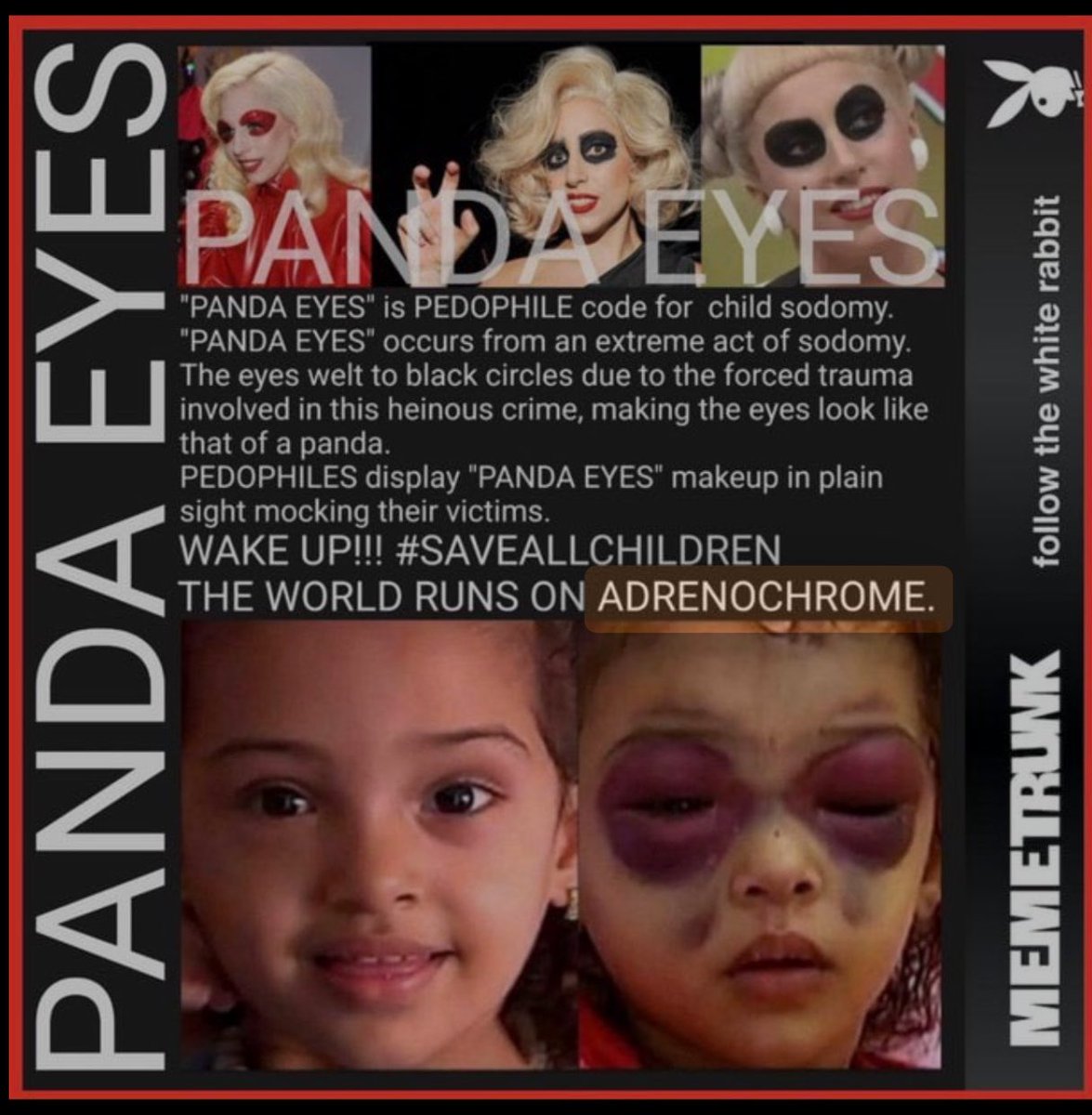 TinaZimmermann4's tweet photo. 💔PANDA EYES" is 
👺PEDOPHILE code for child sodomy
🥲PANDA EYES" occurs from an 
💔extreme act of sodomy. https://t.co/2G0iGwGuVk