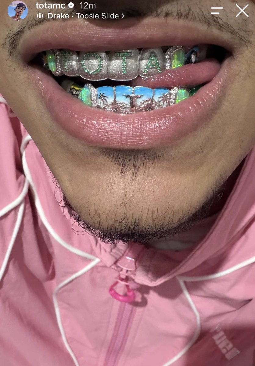 SlatDontMiss's tweet photo. Tota shows off his custom Brazilian grills that he got 👀🔥 https://t.co/wXyqodZd3i