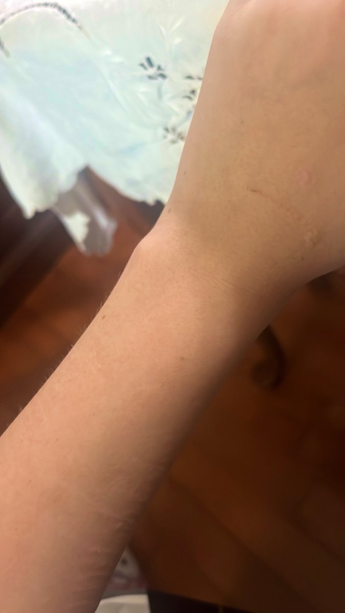 evrybody22's tweet photo. Wristspo?…
#verity #edrtwt #wrist https://t.co/lciKXpNpRO