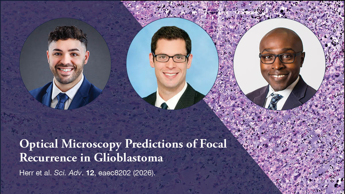 NeurosurgUCSF's tweet photo. In a new @ScienceAdvances study, @SanjeevHerr, Shawn Hervey-Jumper, MD, @ToddCHollon, & their colleagues at @UCSF & @umichneuro present an AI model that predicts where #glioblastoma is likely to recur, paving the way for earlier, targeted interventions. https://t.co/ga5fxqBv3k https://t.co/HHM1rt979g