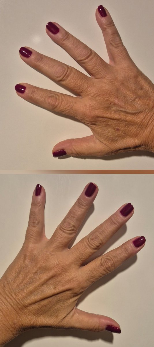chiaramondi's tweet photo. Le #mani.
Il #rosso, un vezzo.
Aiuta l'autostima.
E #ciao. https://t.co/V0GwkGmfF9