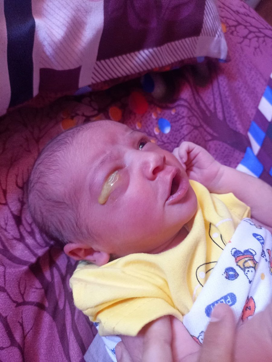 Uncle_kkla's tweet photo. My son is dying😩💔

Sorry to interrupt your scrolling😭🤲🏽

He’s in so much pain and urgently needs surgery😩
He’s battling with deadly rare eye cancer😭💔

He has had some treatment but the Disease is still progressing🥹💔 Pls help in anyway u can to save his life🤲🏽 https://t.co/6PDXG42FDI