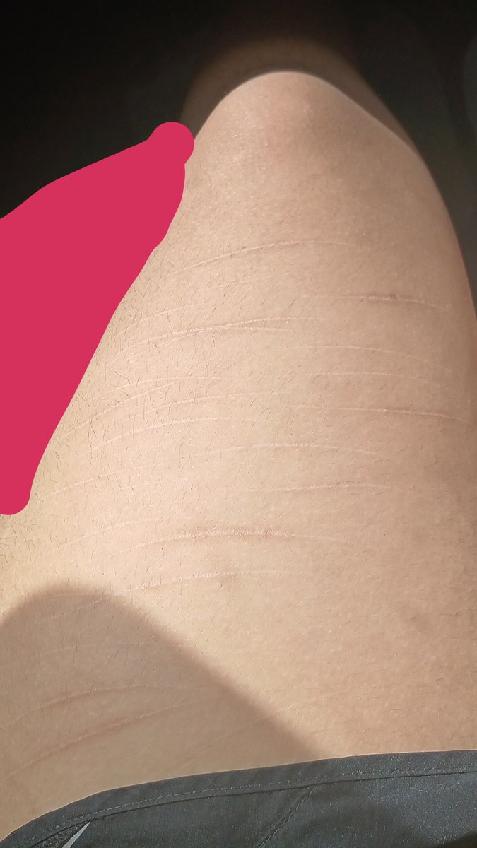 jazz7sr's tweet photo. #shtwt you can barely see them omg  it's so annoying like why do I want people to notice them but I want them to not notice at the same time? Also my first time posting on here ✌️(All fake Halloween makeup! Even tho I doubt that ill get banned) https://t.co/cvKUU1ZVCG