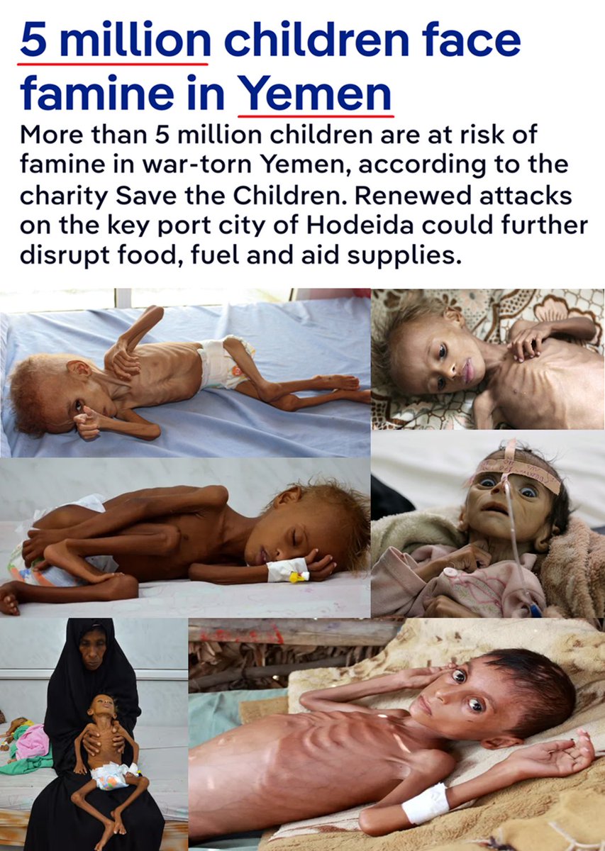 monellove's tweet photo. @sabra_the Meanwhile, a real famine takes place in Yemen! https://t.co/6FbrV8VLpQ