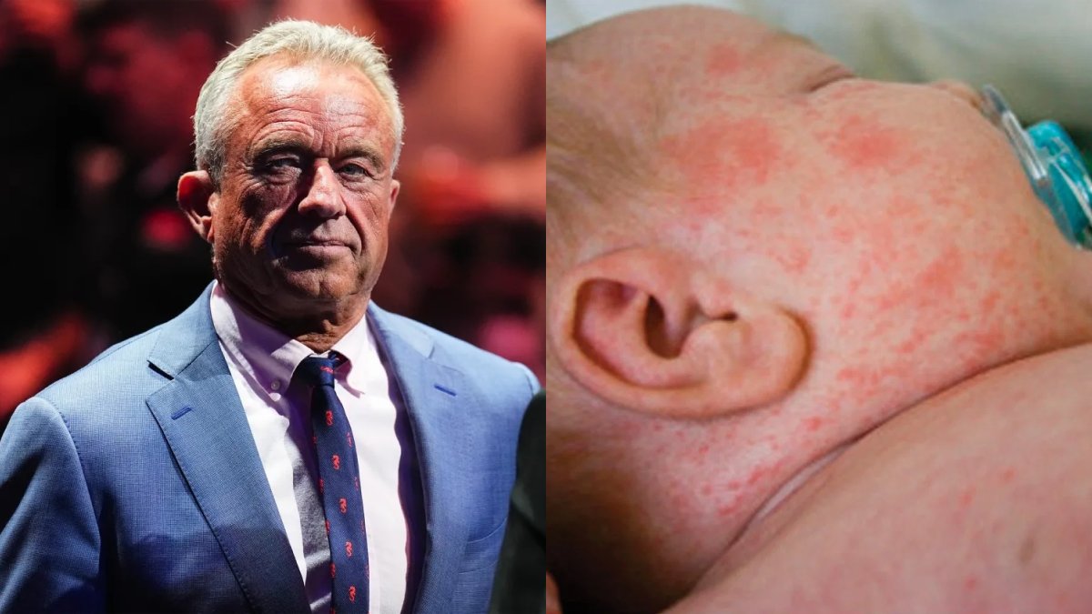 factpostnews's tweet photo. At least 6 babies in Pennsylvania have been born infected with measles. https://t.co/eW4dflqeT3