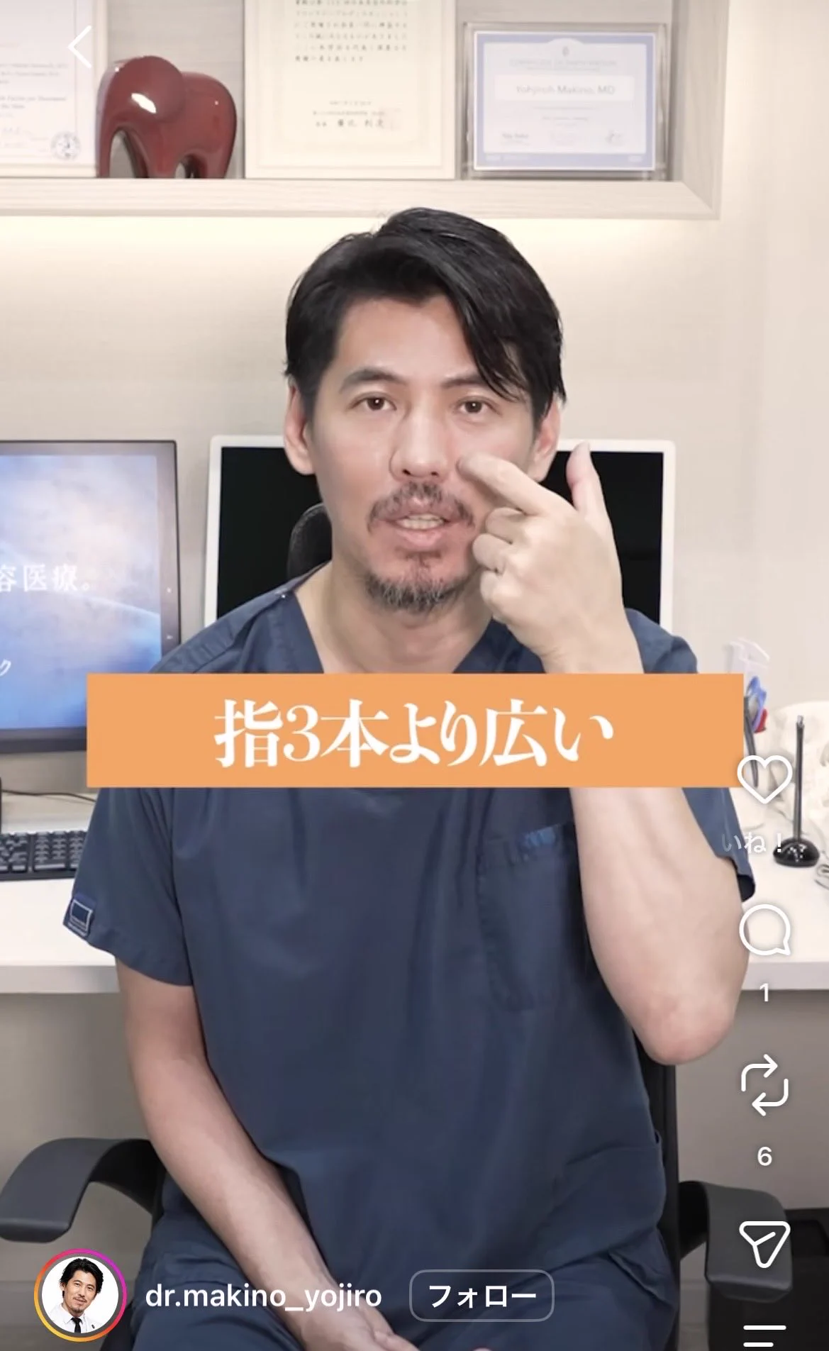 rechi on X: 