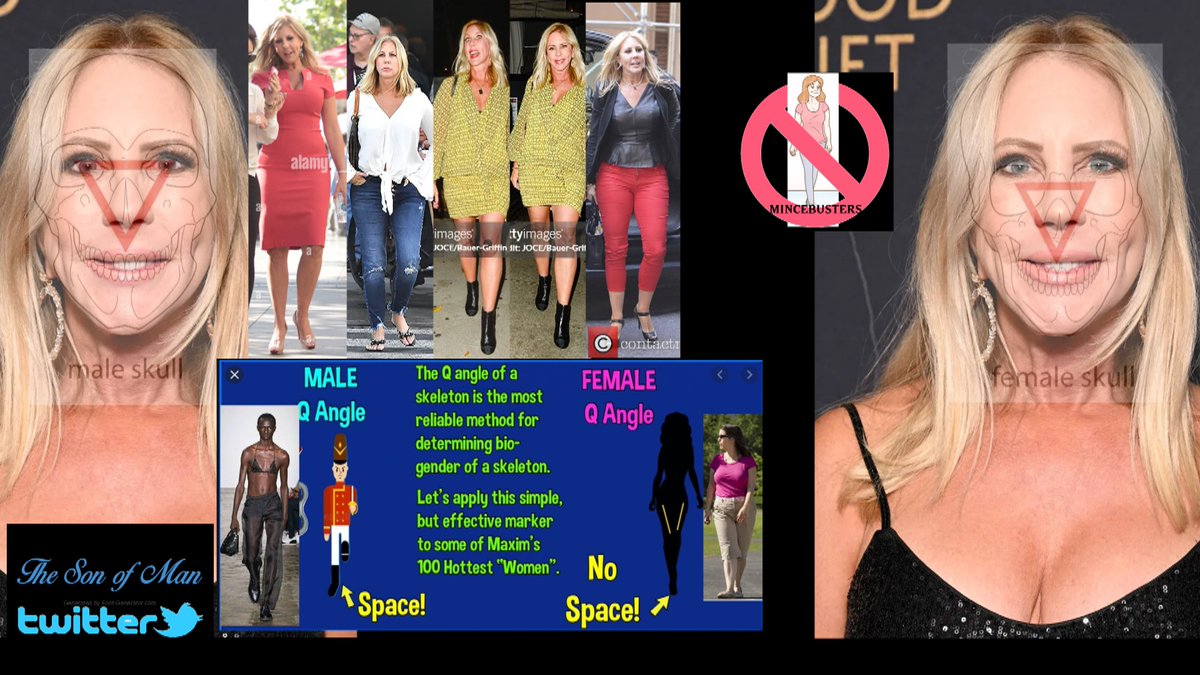 TheSono71468392's tweet photo. Vicki Gunvalson https://t.co/x8ik1EdMyA