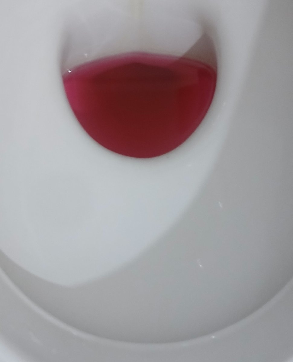 Meg4atr00n_egg's tweet photo. I cleaned my new towel my hands hurts and it looks like I killed someone in the bathroom. It's all red 😭 https://t.co/rhb5cHwltg