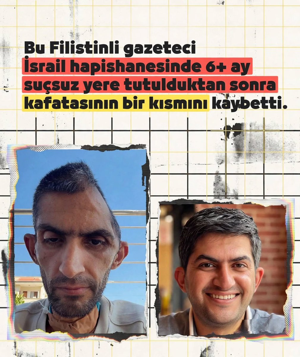 Ferdi_Karabasan's tweet photo. İşgalci siyonist israil hapishanelerinden bir şekilde çıkanların da çoğunun hayatı buna benzer travmalar ile devam ediyor https://t.co/Ud5mMOQVXq