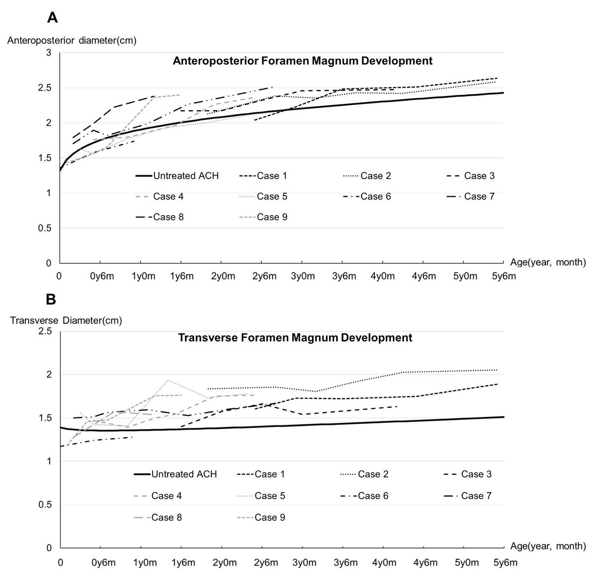 GIMJournal's tweet photo. Foramen magnum stenosis is a major cause of death in young kids with achondroplasia. In 9 infants starting vosoritide before age 3, the foramen magnum outgrew untreated reference curves, independent of height response. https://t.co/n9xmSqJnti https://t.co/8lI5MPj6GK