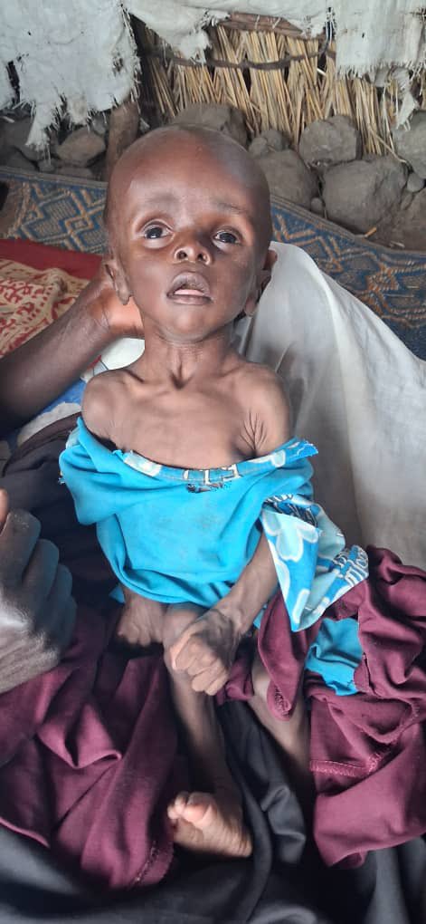 qoga12's tweet photo. In Suni, Jebel Marra, children are at risk of death from severe acute malnutrition amid a critical lack of healthcare. Humanitarian situation is rapidly deteriorating, and children urgently need food, medical care, and lifesaving assistance.@UNICEFSudan @SC_inSudan @NRC_Norway https://t.co/GGdxembc2D