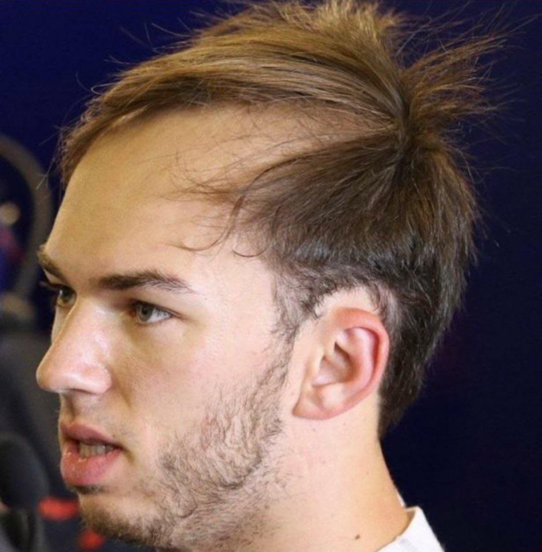 AlpineArg_'s tweet photo. Gasly antes y después de usar Plusbelle: https://t.co/zEedgsfJ6q