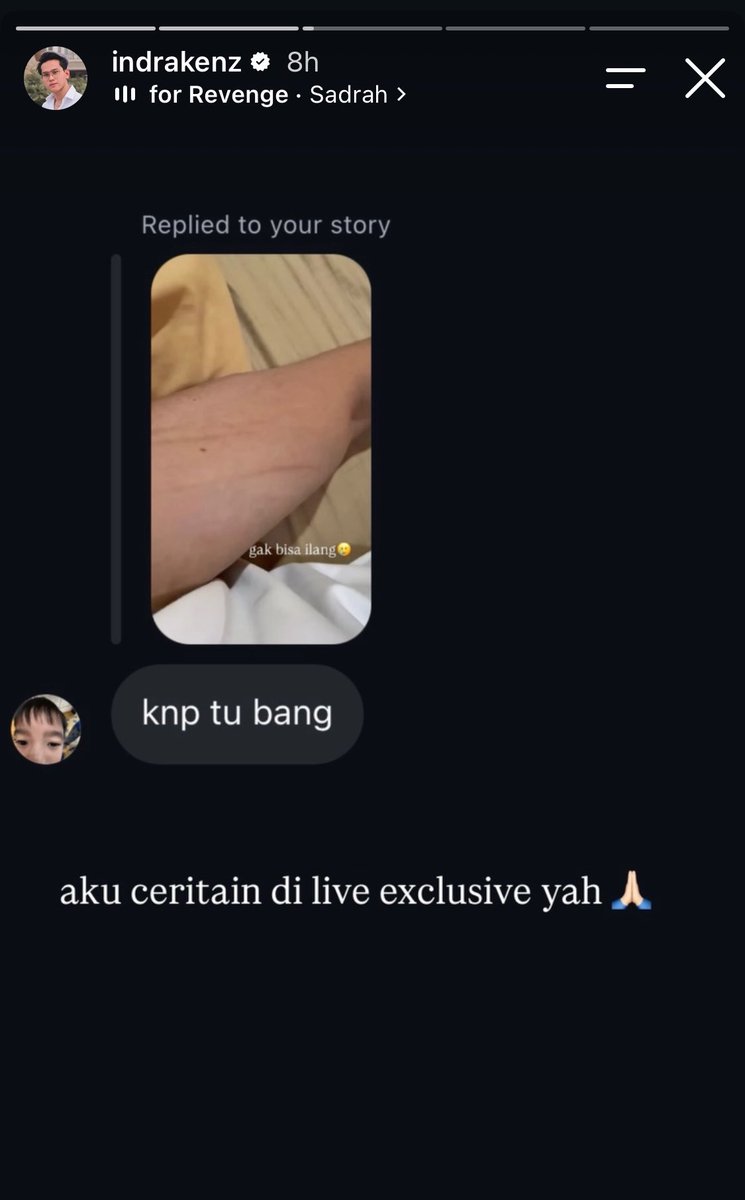 bardanslm's tweet photo. dulu dony salmanan keluar penjara dapet ratusan juta dari exclusive karna mau cerita sesuatu. 

sekarang indra kenz di storynya liatin bekas luka di bagian lengan bawah, dan mau cerita hanya untuk di live exclusive. 

enak yak jd influencer keluar tahanan auto bisa dapet ratusan juta dari exclusive. 

apakah sebenarnya ini kunci sukses??? 🙏🏻🙏🏻🙏🏻