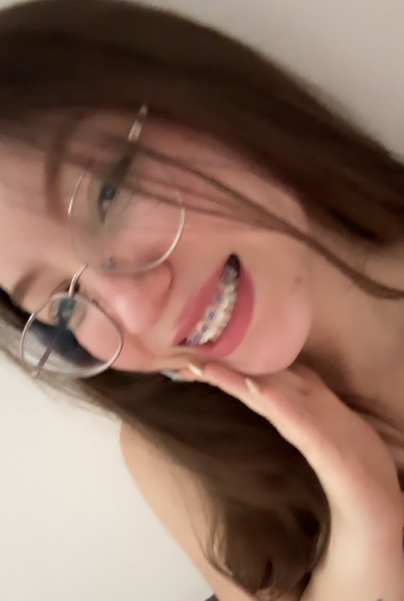 mily_vs00's tweet photo. Pensé q me iban a quedar más horribles estos fierros (Me enamoré de mi misma pero me quiero arrancar los dientes ya) https://t.co/fhcnwgogqP
