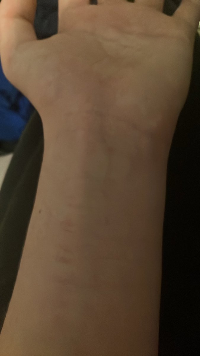 Kazuhiram1's tweet photo. i just need one good swipe right there, vertical or just deep
and its all over https://t.co/1lMwRDzCUY