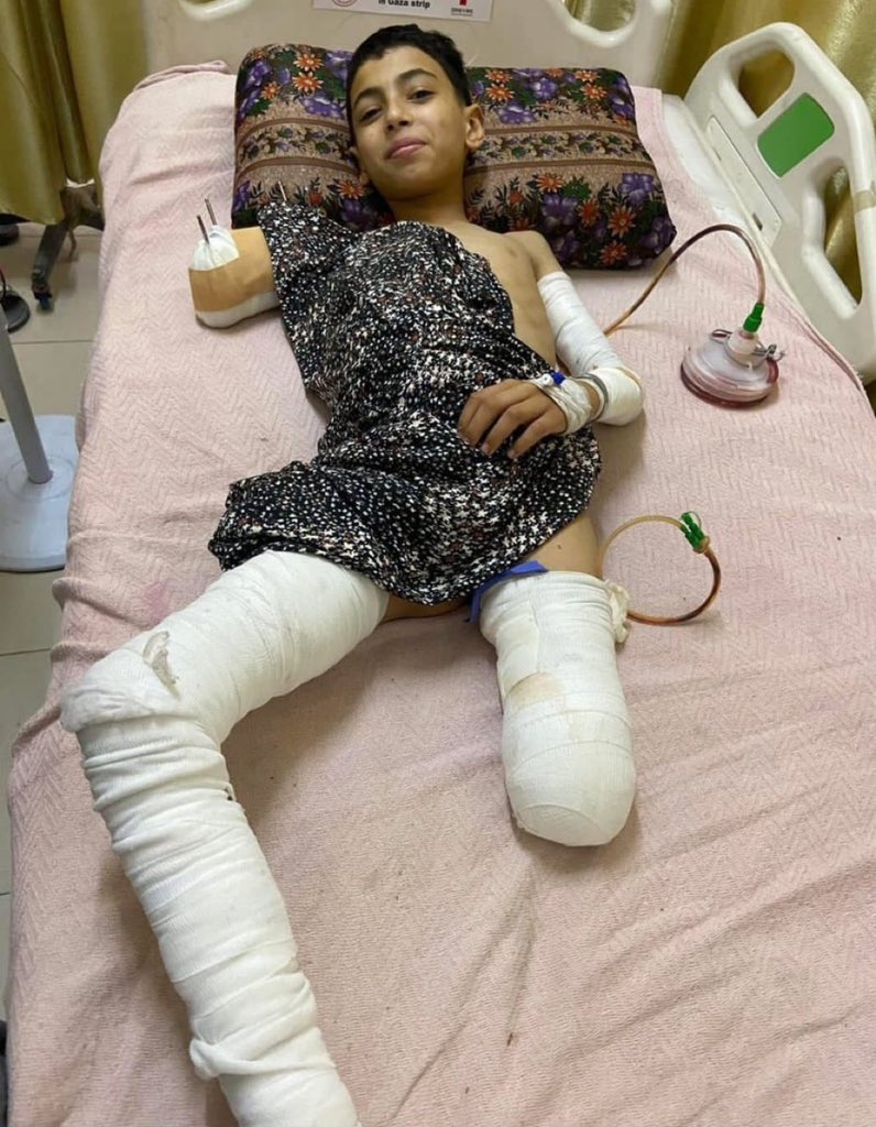 AHMED_ABUHAMAD_'s tweet photo. اللهم لا تجعل وجعهم يمرّ كأن شيئًا لم يكن .

كل طفلٍ في غزة شاهدٌ على زمنٍ قاسٍ لم يرحم براءته .

اللهم إن عجزت أيدينا، فلا يعجز دعاؤنا … كن لأهل غزة .

والله وحده يعلم كم حملت غزة من وجعٍ لا يُروى . https://t.co/jlZruajxEd