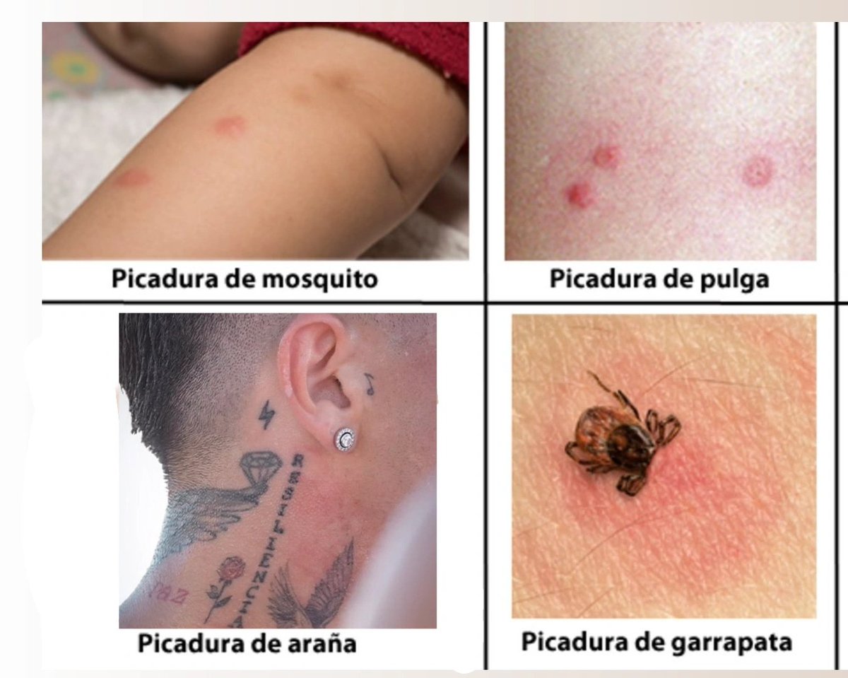 mortgagedbrain's tweet photo. No hay fumigadores allá en Ezeiza? Te puedo recomendar uno de acá de Tolosa https://t.co/cVg8Lb3cBw