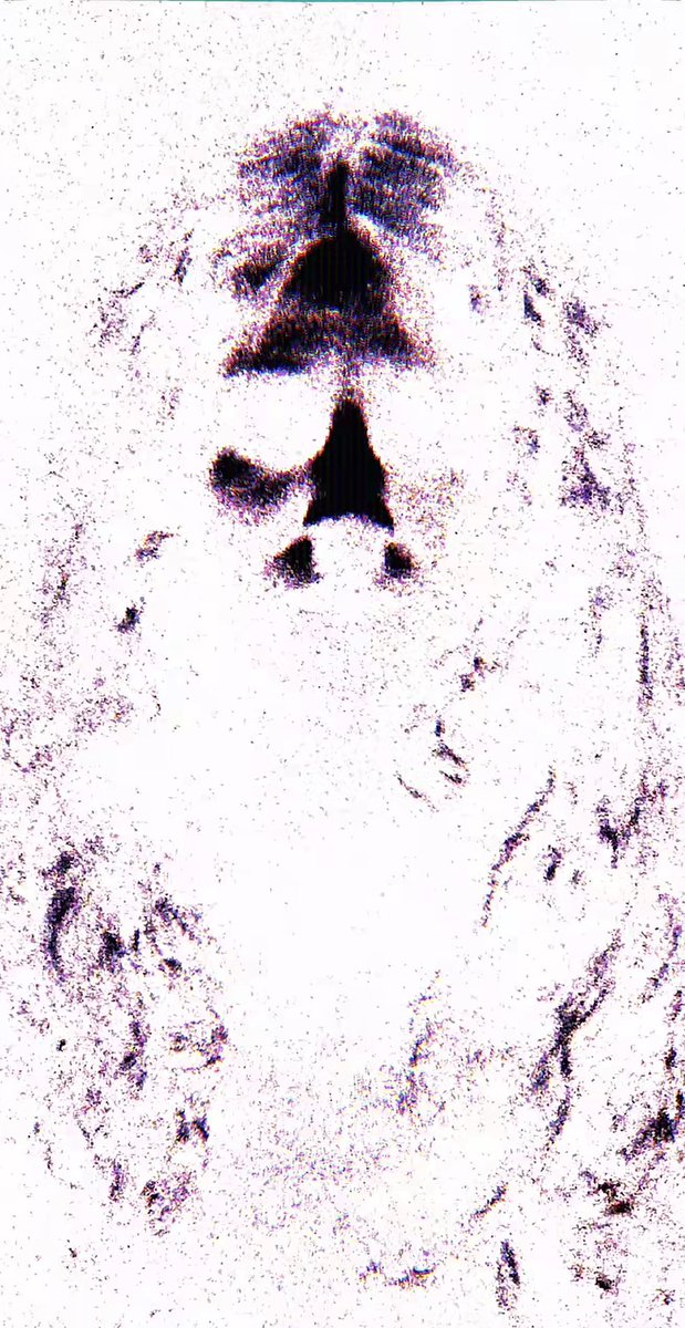 Slim3Brain's tweet photo. Rob Zombie x Fortnite Confirmed

#fortnite #fortnitemares https://t.co/s1LuOHnlq7