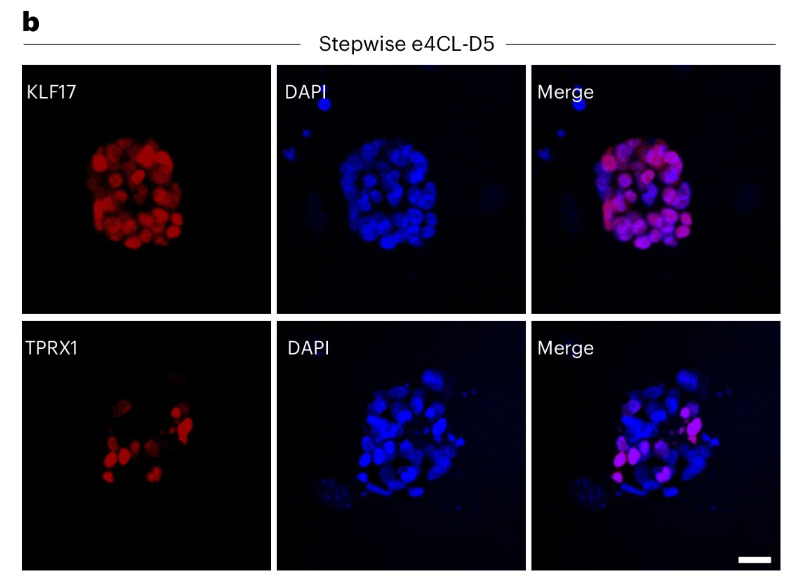 ESC_iPSC_News's tweet photo. Researchers established a controllable transgene-free methodology to generate totipotent eight-cell embryo-like cells (#8CLCs) from human #PluripotentStemCells in vitro. π¬
Learn more: https://t.co/7dlvwxpljg | @NatureProtocols https://t.co/kVmS0H4pm9
