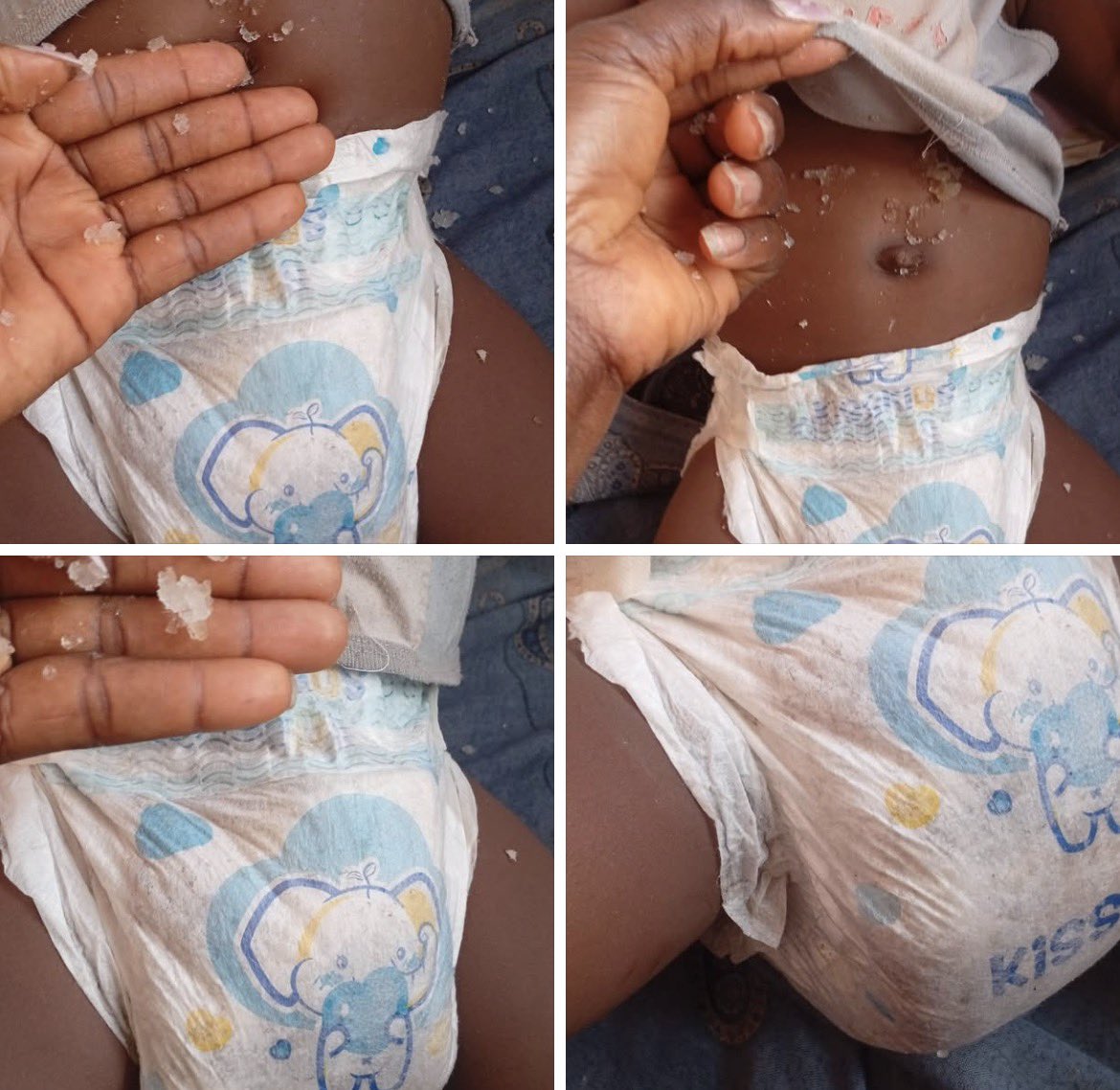 oma22k's tweet photo. I am honestly SO upset right now 😩😭

I went to pick my toddler up from daycare today, and this is what I met… a completely soaked diaper while my baby was sleeping. 😭💔

As a mother, this one really paiñed me. 💔

The diaper was m this full, and my baby had been sleeping in it. My biggest question is… HOW LONG had he been left like that? 😔

I understand that caregivers have several children to attend to, but please… how do you miss a diaper that is already this soaked? 😭

We leave our children in daycare because we trust that they will be cared for, protected and treated with love when we aren't there.

I'm trying my best not to react out of anger, but honestly, I'm VERY, VERY pissed right now. 😩

Mothers, please tell me honestly… what would you do if you were in my shoes? Would you confront the caregiver immediately or calm down first before addressing it? 👇🏽

Because right now, I need advice before my añger speaks for me. 😭

A lady shared on her social.