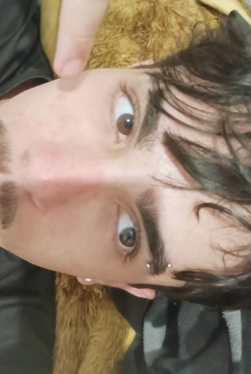 NotCelta's tweet photo. they pierced metal in my face https://t.co/rozNzJ54Ff