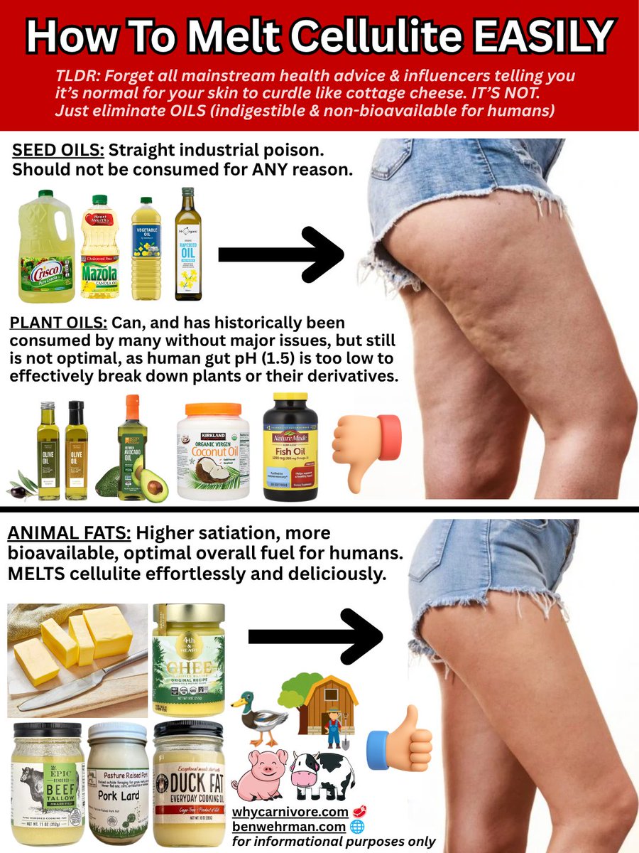 benwehrman's tweet photo. Fun fact for any women dealing with cellulite on their butt/legs

It's caused by OILS

The human body does not have the ability to break down plants or their derivatives (we have a gut pH of 1.5, meaning we are more carnivorous than a lion 🦁🥩)

Cut out the SEED OILS first, as they are straight industrial poison

Then, cut out all the other non-bioavailable oils that the clueless and/or brainwashed "health influencers" told you are healthy for you (coconut oil, olive oil, avocado oil, fish oil, etc.), and replace them with ANIMAL FATS, which are extremely bioavailable, i.e. our bodies are actually designed to break them down into usable fuel

Butter, beef tallow, lard, ghee, duck fat...you can find them at any grocery store. Try them all out, and choose whichever one you like best

Get back to me in a few months when your cellulite is gone or at least greatly reduced. Your increased self-confidence and happiness is all the thanks I need ❤️

Come back tomorrow for more hotness-increasing tips 💪🔥