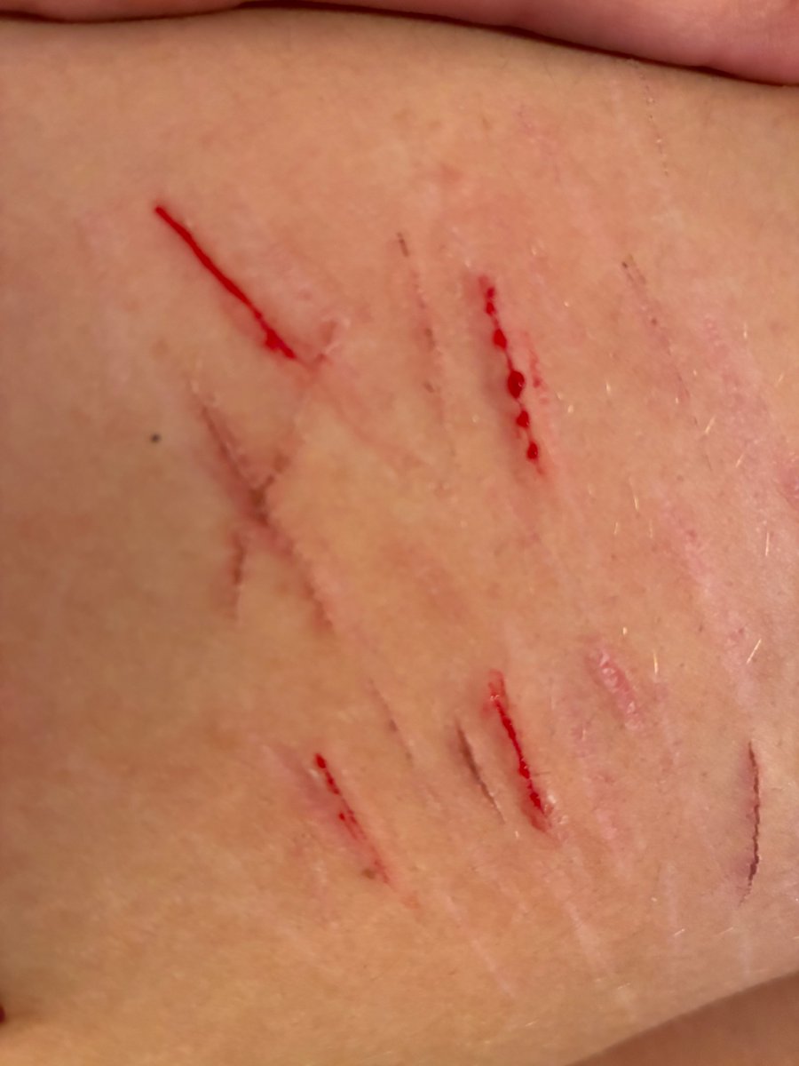 sk3litas_diary's tweet photo. Baby sesh!

#shedrtwt #catscratches https://t.co/zLWBuuWvCu