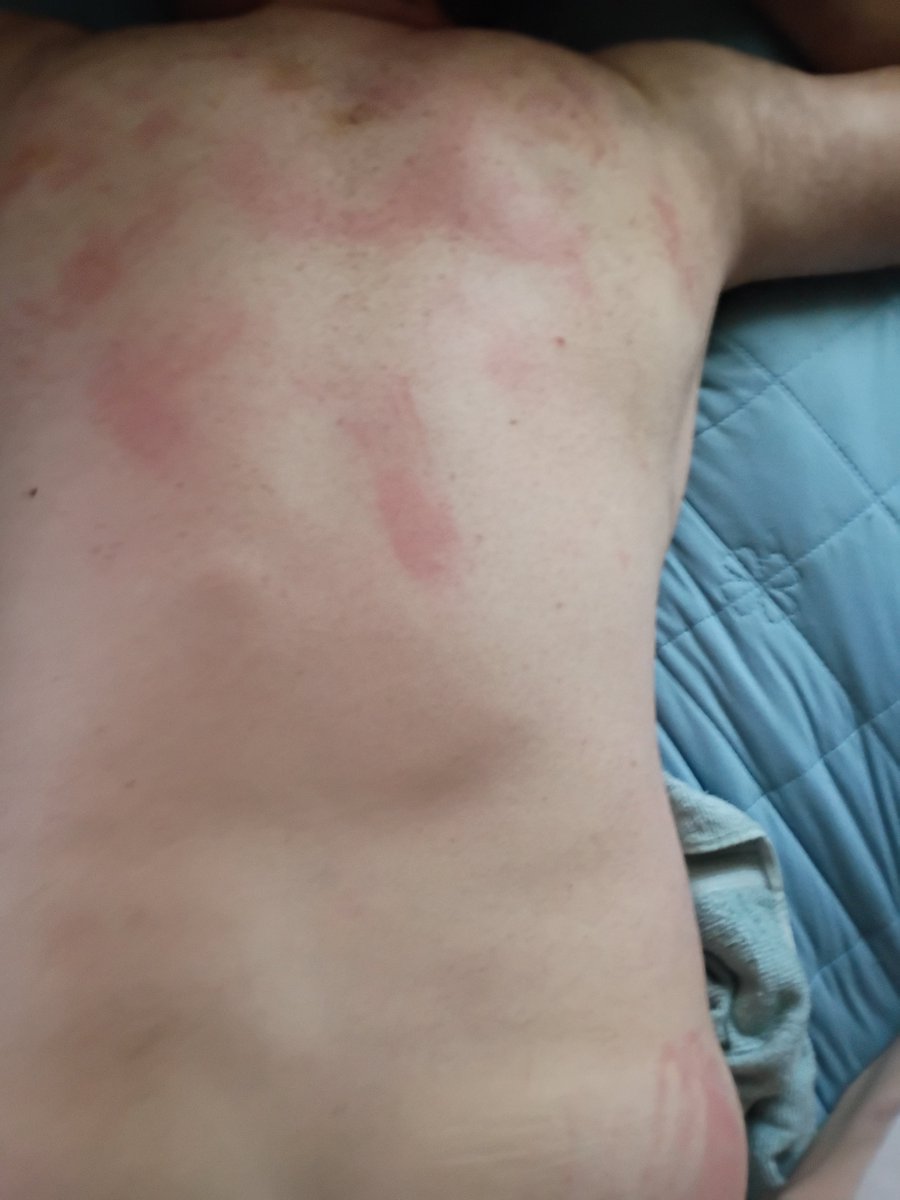 Domme822's tweet photo. A public safety pig after a impact play session with his his dom medic https://t.co/P7sXrxq6Io
