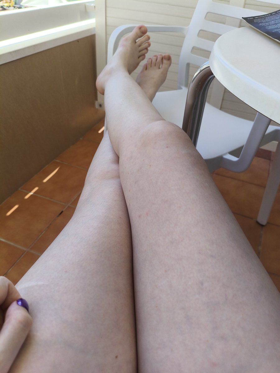 playwithCooki3's tweet photo. Even though I'm on a boiling hot holiday I'm still a pale alt girly 🦇💅🏻

#holiday #alternitive #altgirl #paleskin #vampire #allthingsworn #holidayfeet #freefeet #palelegs #femdom #strongfemale #spain #gothgirl #emogirl #spoiled #piggy #spendonme https://t.co/Elqo8at6FZ