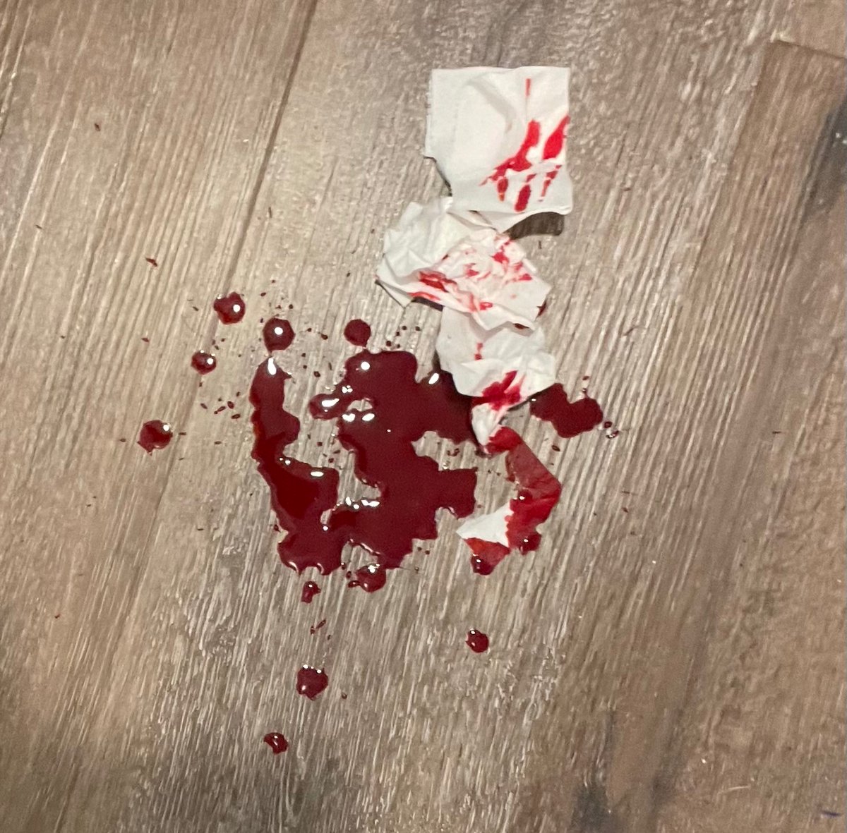 salix1121's tweet photo. i wish i was dead ,, new fake specail effects blood recipe https://t.co/8FJZNSAYAg