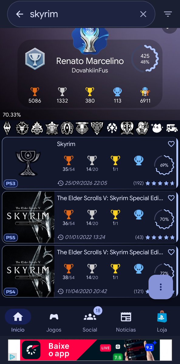 KzLidius's tweet photo. Platinado!!!

Platina 113ª

The Elder scroll: Skyrim PS3

Agora tenho a platina nas 3 versões! 😀

#skyrim #PS3 #Playstation https://t.co/LDHVuU8oIL