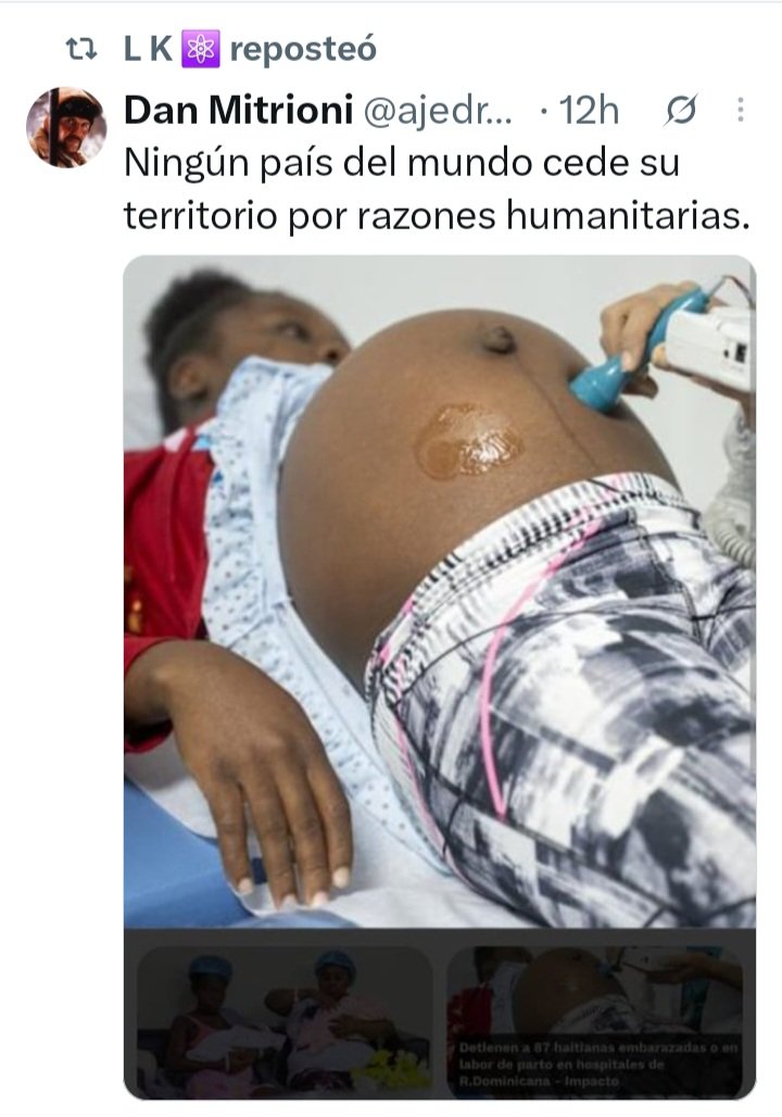 CornelioMella's tweet photo. Un Gobierno *
Que Vive Haciendo El Papel
De Pendejo y Idiota En la RD.
@ciprianreyes @Manuelcruztv 
@ManuelEmil99380 https://t.co/OJl2QjPXr2