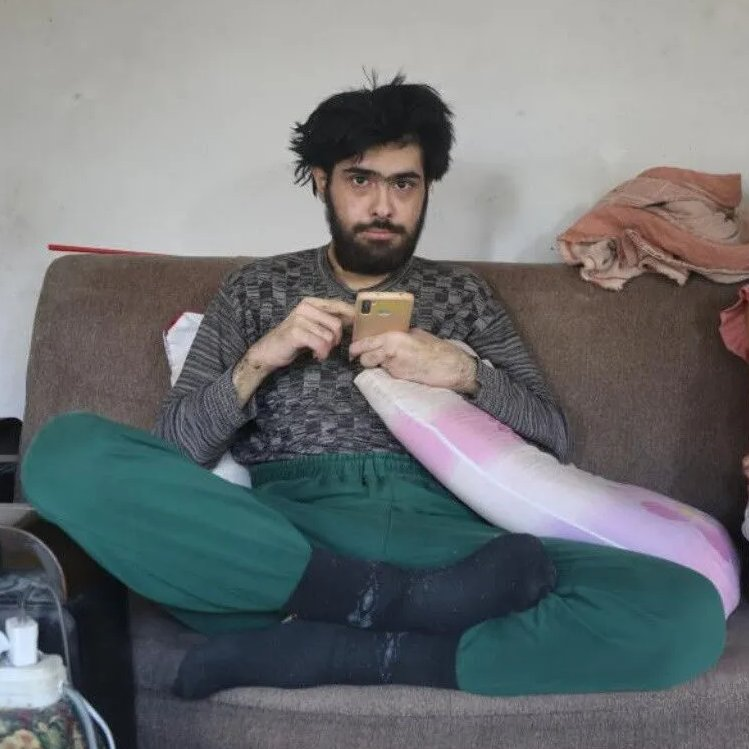 bosunatiklama's tweet photo. Hatay'da deprem sonrası depresyona girerek 3 yıldır evden çıkmayan Barış Özbay'ın son hali: https://t.co/DZz9gy9otc
