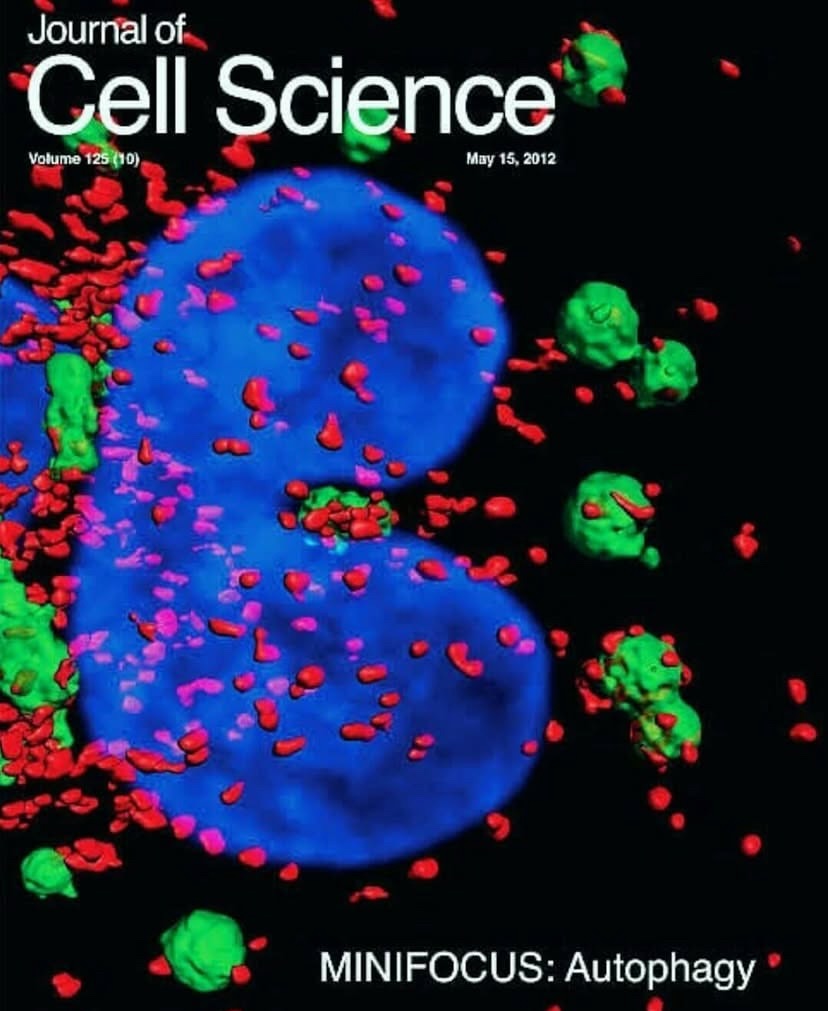williamsnayder's tweet photo. Otofaji, 2012 Mayıs Science sayısında dikkatleri çekmişti ancak orucun sağlık üzerindeki etkilerini açıklayan çok daha eski ve temel bir kavramdır. Hücrenin yaşlı, işlevsiz veya riskli yapılarını 'yiyerek' yok etmesi olan bu süreçte oruç, en güçlü hı... https://t.co/yt1TbMlgzv